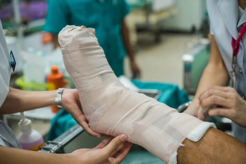 A fracture is a break or crack in a bone.